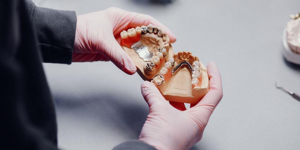 Gloved hands holding models of upper and lower dentures