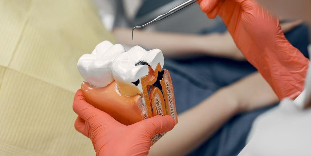 Gloved hands holding a tooth model and a dental instrument