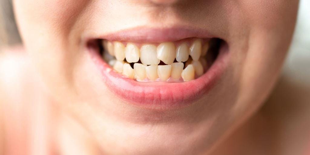 Close-up of a smiling mouth