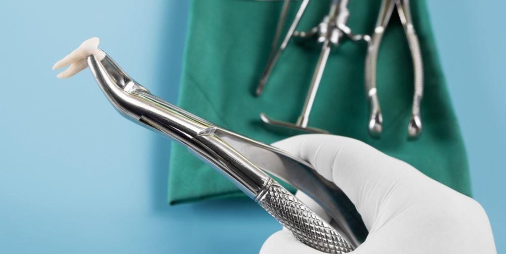 Dental forceps holding an extracted tooth