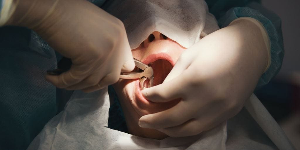 A patient receiving dental treatment