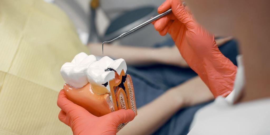 Gloved hands holding a cross-section model of a tooth