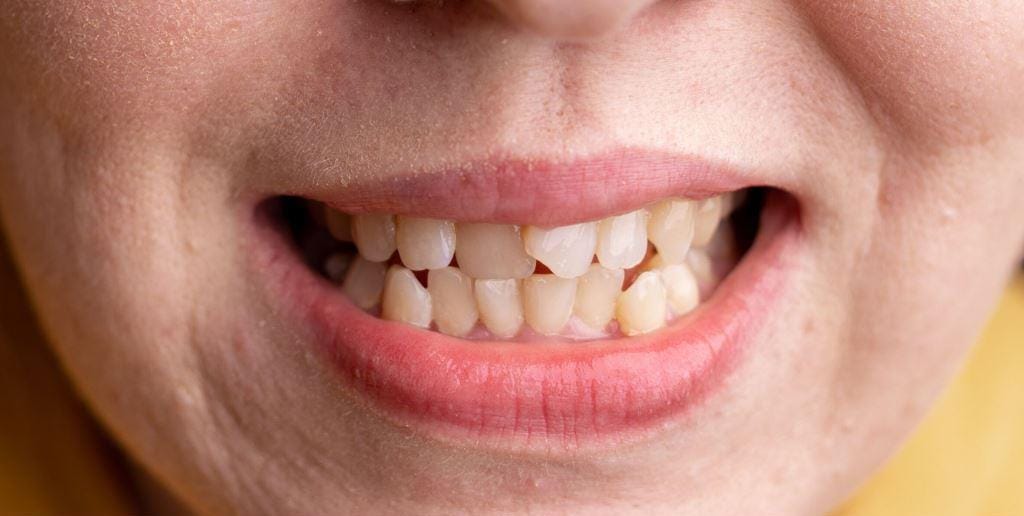 A close-up of a smiling mouth