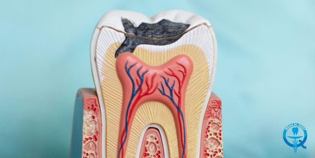 Cross-section tooth model showing the pulp and surrounding layers