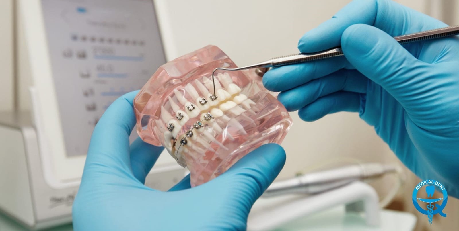Dental professional demonstrating braces on a model