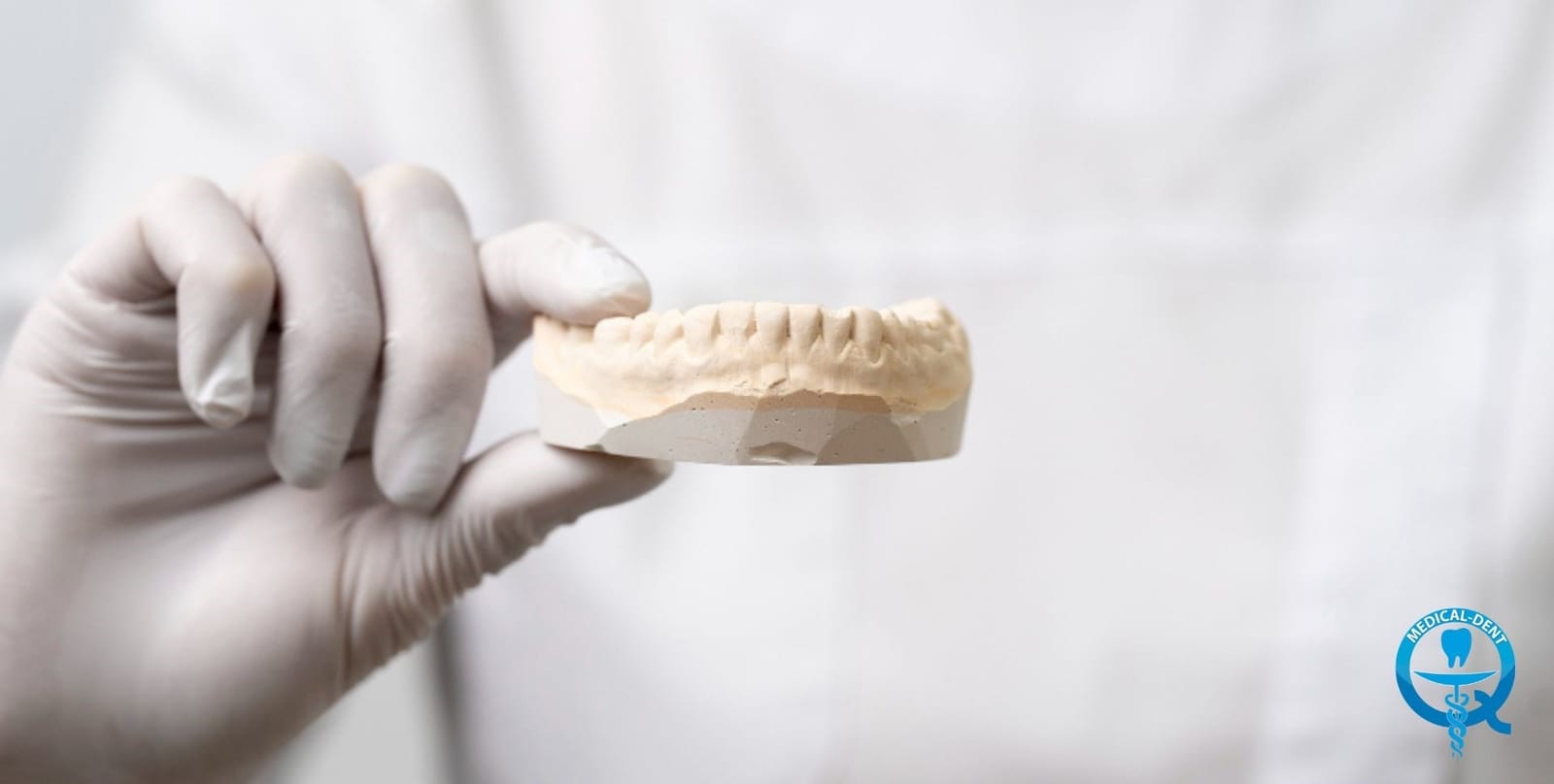 A gloved hand holding a dental model