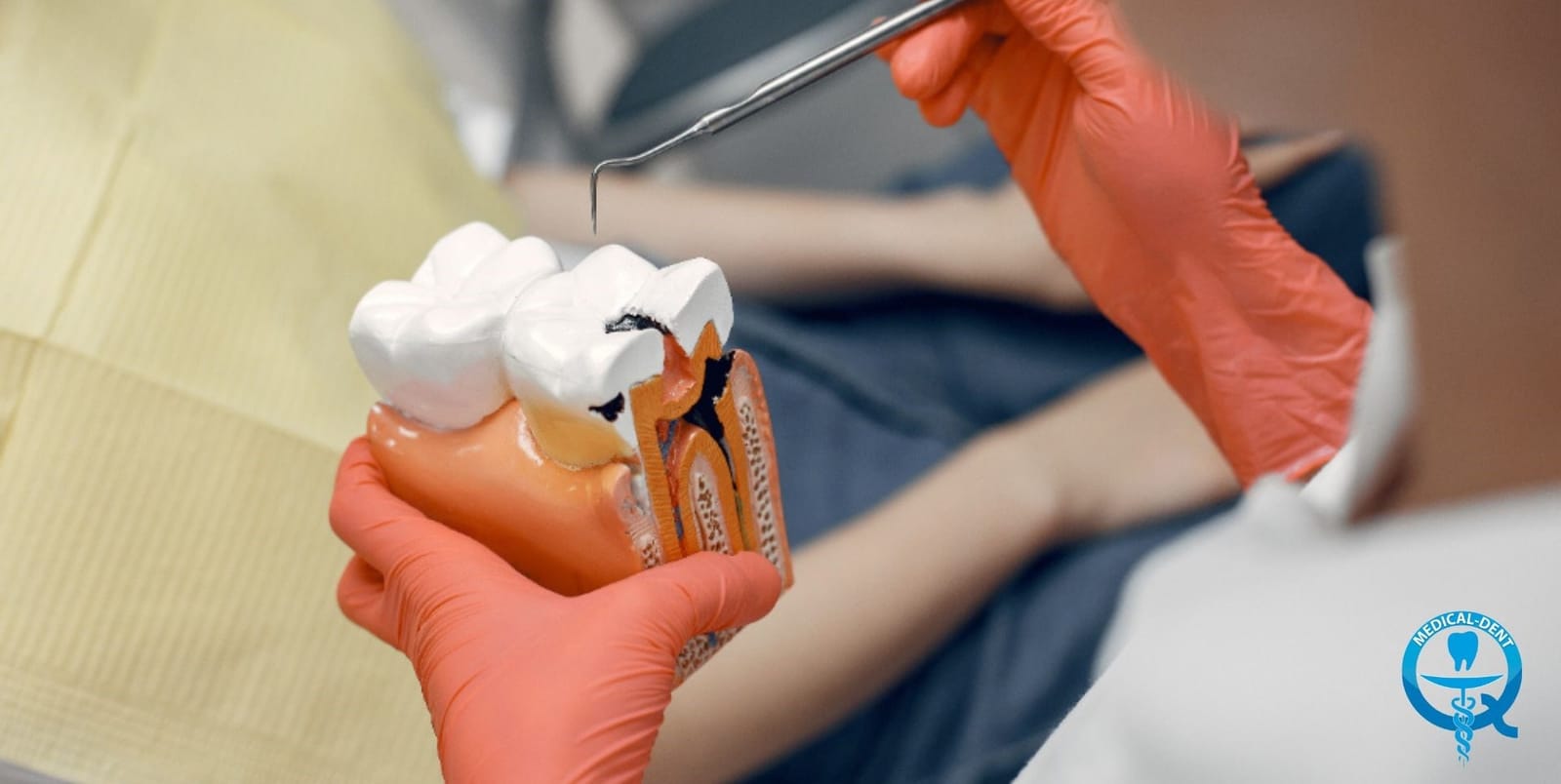 A cutaway tooth model held beside a dental instrument