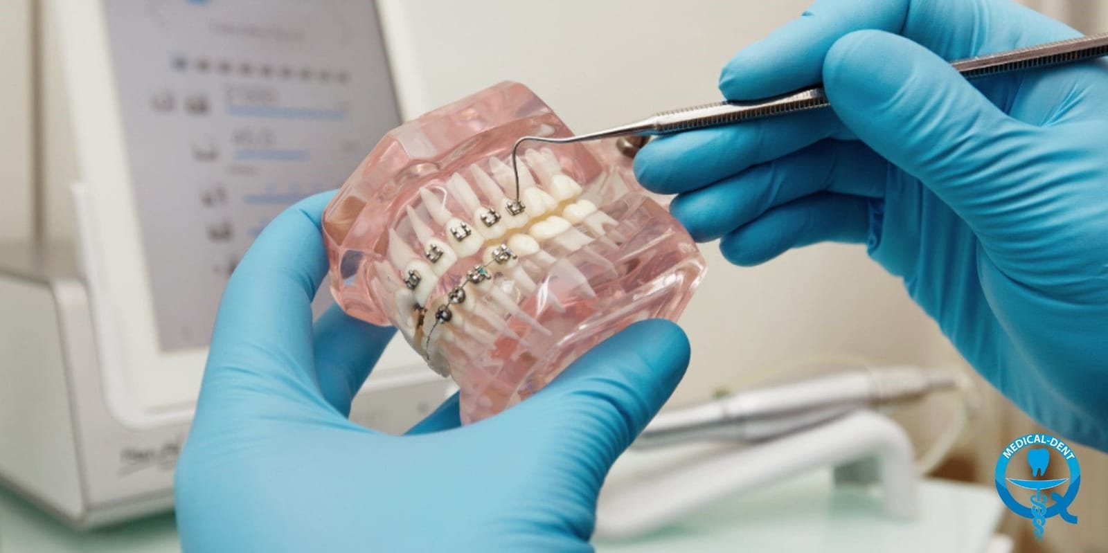 Gloved hands holding a model fitted with braces