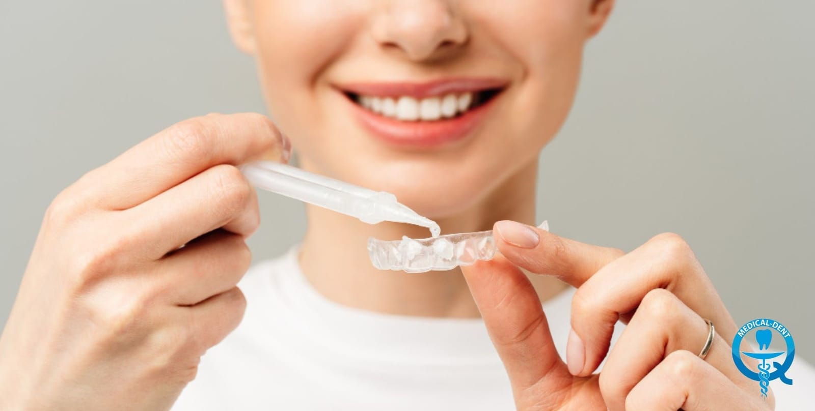 A person adding whitening gel to a clear tray