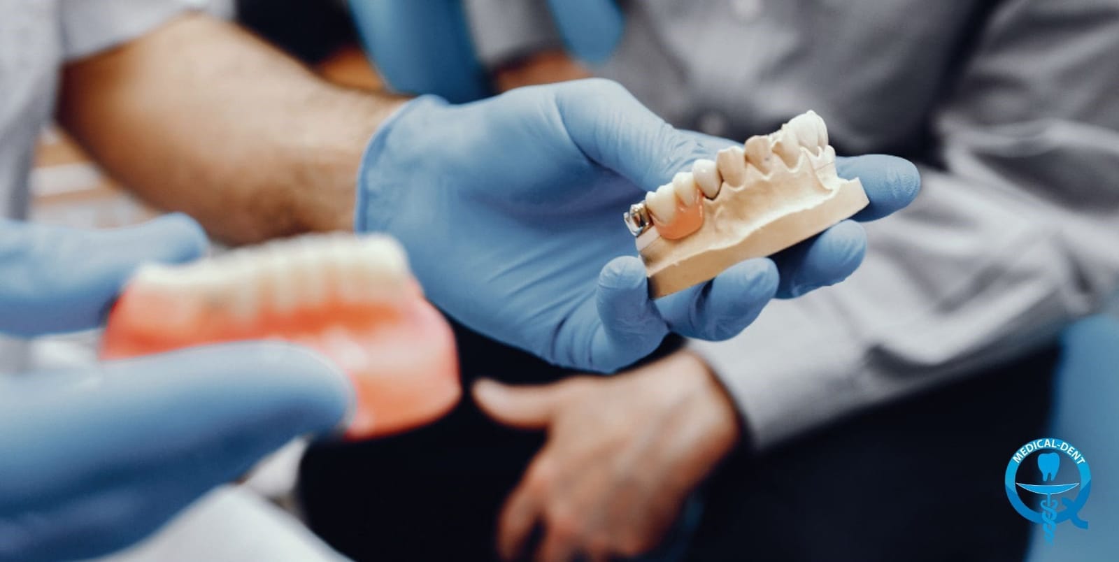 Gloved hands holding a dental model and a denture