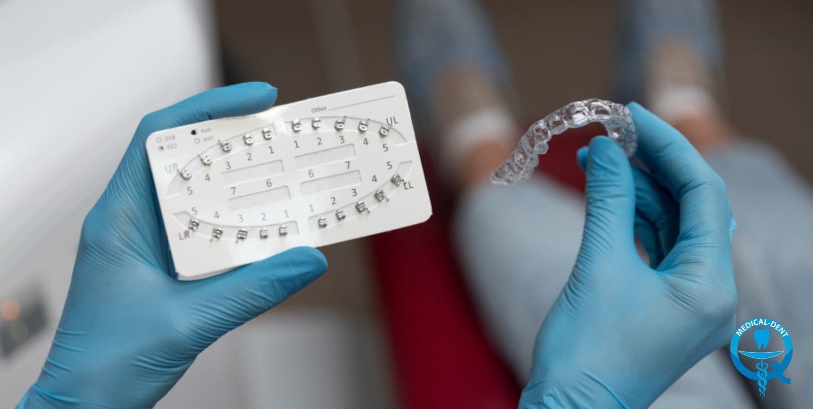 Gloved hands holding a clear dental tray and a dental chart
