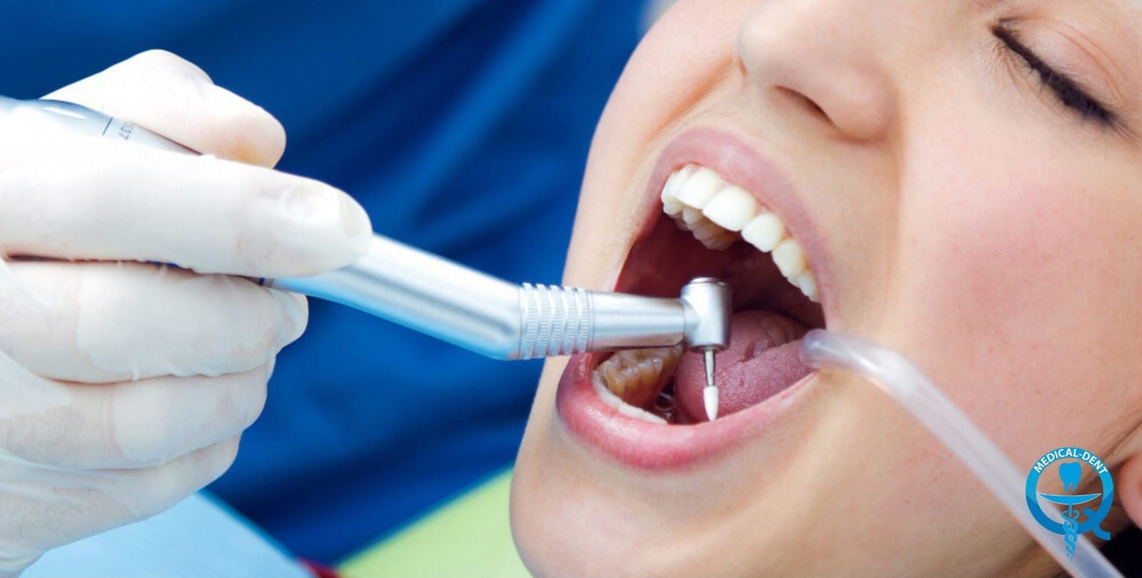 A dental handpiece being used inside a patient’s mouth