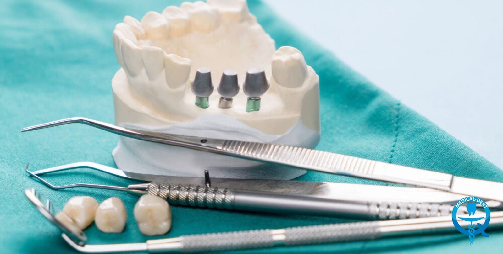 Dental model showing implant components and crowns beside instruments