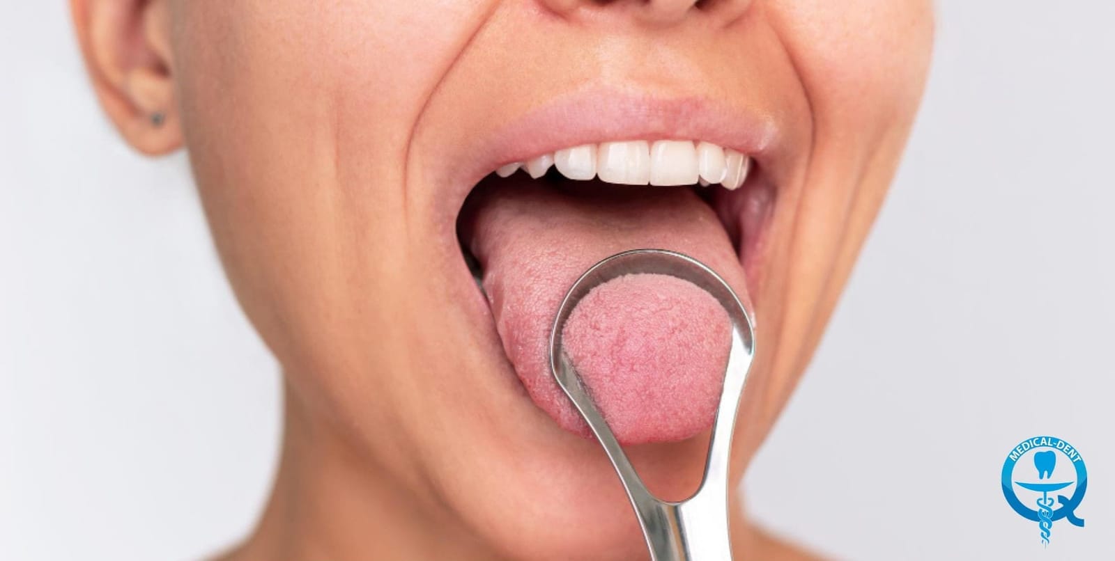 Tongue scraper being used on the tongue