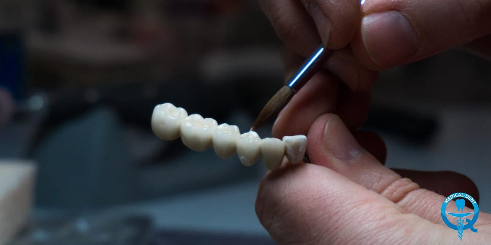 Hands applying a brush to a dental restoration