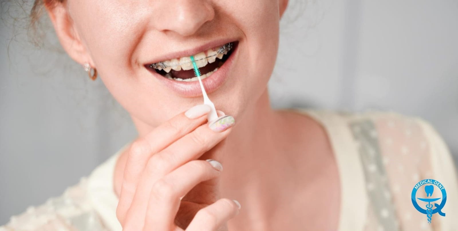 Woman using an interdental brush around fixed braces