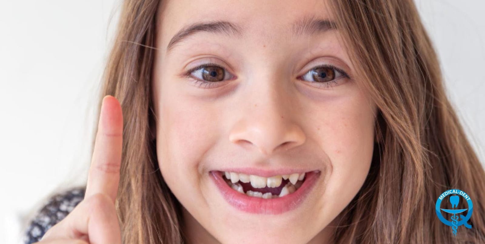 A smiling child with gaps where front teeth are missing